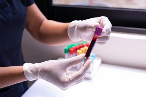 blood-test
